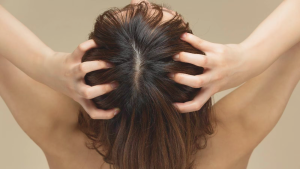 Hair and Scalp Infections